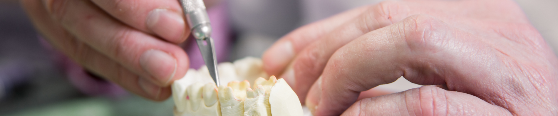 Parodontologie - zu sehen ist, wie jemand mit einem Skalpell einen Abdruck eines Gebisses bearbeitet