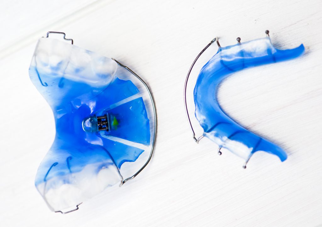 Kieferorthopädie - zu sehen ist eine Behandlungssituation in der Praxis