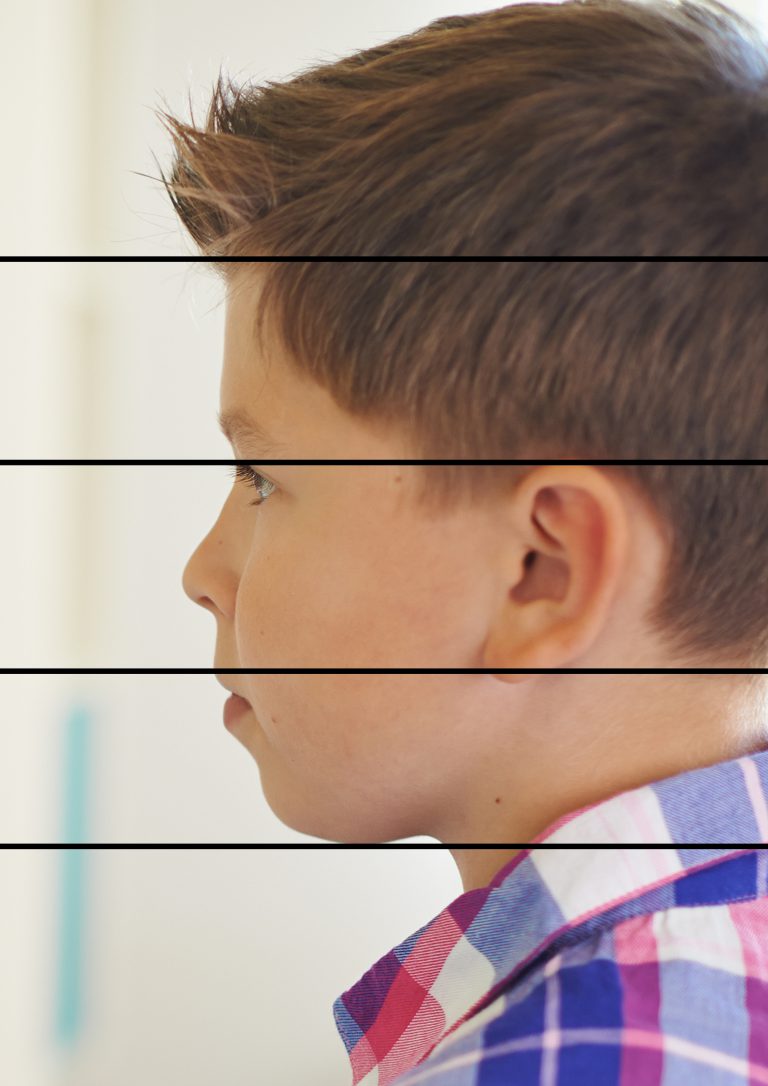 Kieferorthopädie - zu sehen ist eine Behandlungssituation in der Praxis