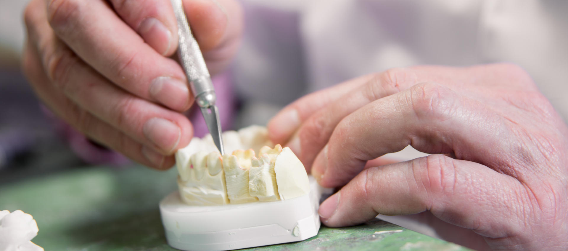 Foto Allgemeine Zahnheilkunde und Chrirurgie - zu sehen ist, wie jemand mit einem Skalpell einen Abdruck eines Gebisses bearbeitet